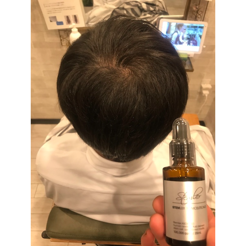 カット、羊水幹細胞培養液スパ・本所吾妻橋美容室オリーブ